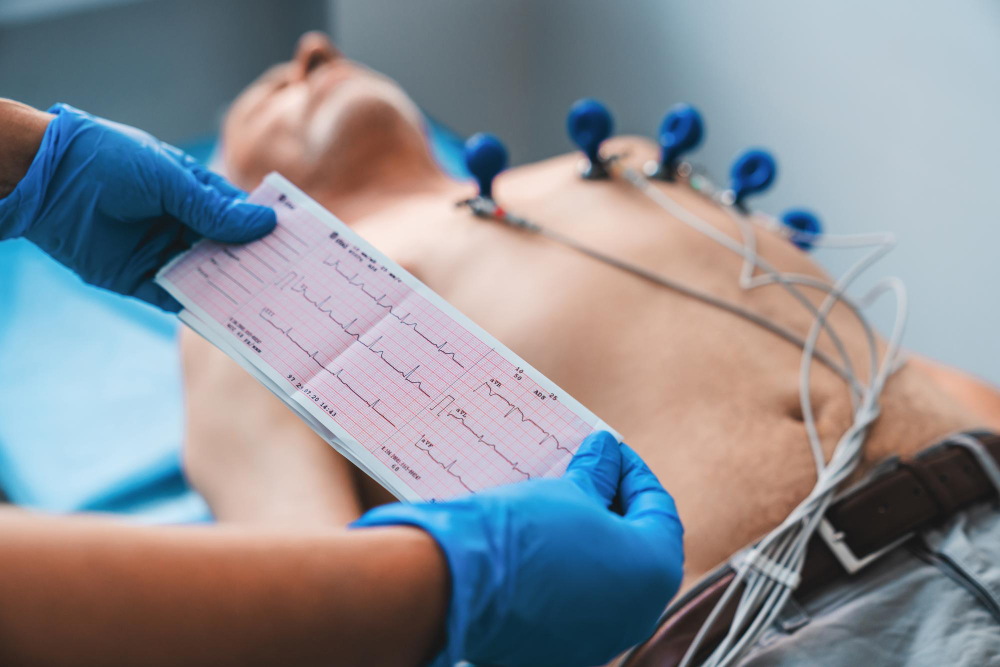 Holter EKG